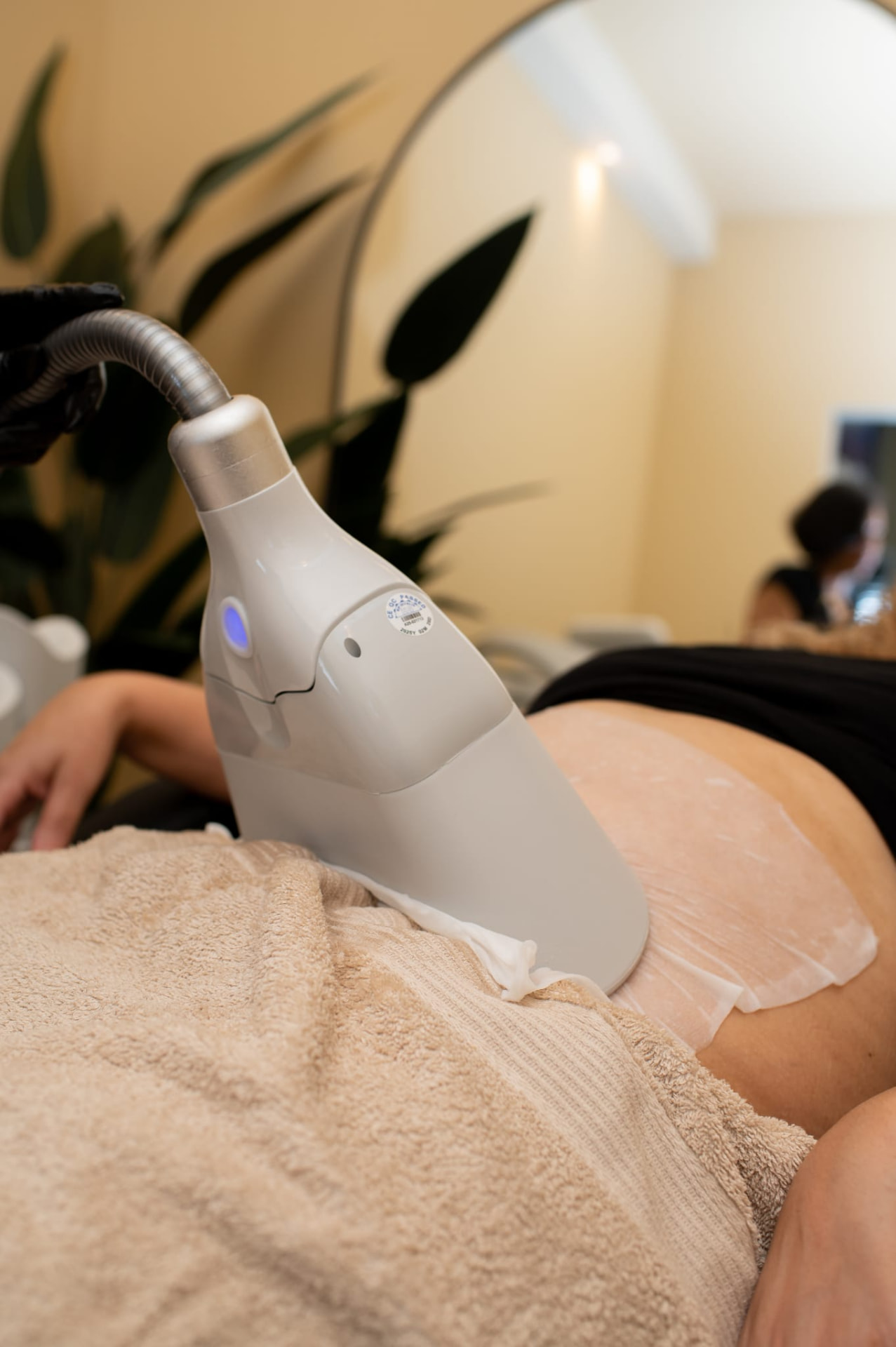 Cryolipolyse-applicator tijdens een behandeling op de buik bij Macdora in Sliedrecht